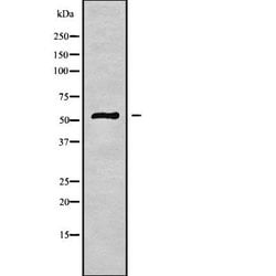 Invitrogen TUBE1 Polyclonal Antibody 100 &mu;L | Buy Online | Invitrogen&trade; | Fisher Scientific