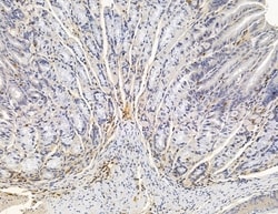 Invitrogen TIAF1 Polyclonal Antibody 100 &mu;L; Unconjugated:Antibodies,