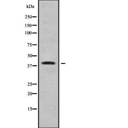 Invitrogen WNT7B Polyclonal Antibody 100 &mu;L | Buy Online | Invitrogen&trade; | Fisher Scientific