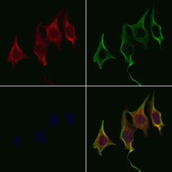Invitrogen WNT8A Polyclonal Antibody 100 &mu;L; Unconjugated:Antibodies,