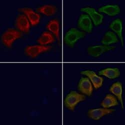 Invitrogen WNT9A Polyclonal Antibody 100 &mu;L; Unconjugated:Antibodies,