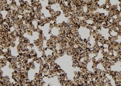Invitrogen Cyclin B2 Polyclonal Antibody 100 &mu;L; Unconjugated:Antibodies,