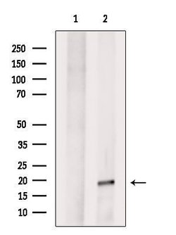 Invitrogen MYLPF Polyclonal Antibody 100 &mu;L; Unconjugated:Antibodies,