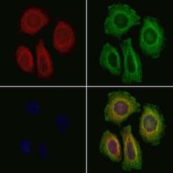 Invitrogen Laminin gamma-2 Polyclonal Antibody 100 &mu;L; Unconjugated:Antibodies,