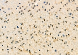 Invitrogen CENPC Polyclonal Antibody 100 &mu;L; Unconjugated:Antibodies,