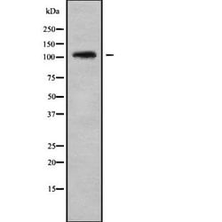 Invitrogen CENPC Polyclonal Antibody 100 &mu;L; Unconjugated:Antibodies,
