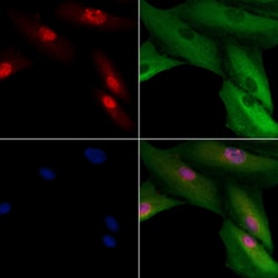 Invitrogen CENPH Polyclonal Antibody 100 &mu;L; Unconjugated:Antibodies,