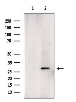Invitrogen CENPH Polyclonal Antibody 100 &mu;L; Unconjugated:Antibodies,