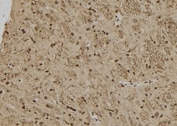 Invitrogen HUS1B Polyclonal Antibody 100 &mu;L; Unconjugated:Antibodies,