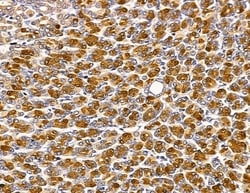 Invitrogen HUS1B Polyclonal Antibody 100 &mu;L; Unconjugated:Antibodies,