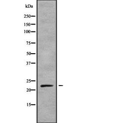 Invitrogen KappaB ras1 Polyclonal Antibody 100 &mu;L; Unconjugated:Antibodies,