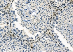 Invitrogen MYCNOS Polyclonal Antibody 100 &mu;L; Unconjugated:Antibodies,