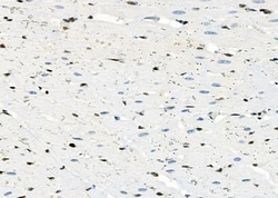 Invitrogen MYCNOS Polyclonal Antibody 100 &mu;L; Unconjugated:Antibodies,