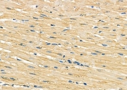 Invitrogen GOLT1B Polyclonal Antibody 100 &mu;L; Unconjugated:Antibodies,