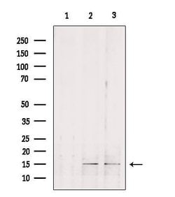 Invitrogen GOLT1B Polyclonal Antibody 100 &mu;L; Unconjugated:Antibodies,