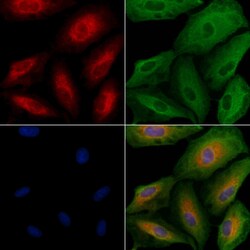 Invitrogen ALKBH7 Polyclonal Antibody 100 &mu;L; Unconjugated:Antibodies,