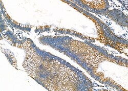 Invitrogen ALKBH7 Polyclonal Antibody 100 &mu;L; Unconjugated:Antibodies,