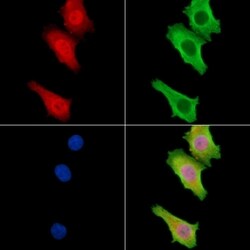 Invitrogen TNIP3 Polyclonal Antibody 100 &mu;L; Unconjugated:Antibodies,