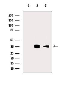 Invitrogen TNIP3 Polyclonal Antibody 100 &mu;L; Unconjugated:Antibodies,