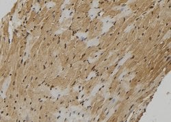 Invitrogen FMR1NB Polyclonal Antibody 100 &mu;L; Unconjugated:Antibodies,