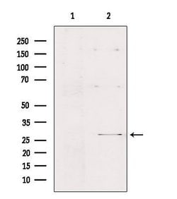 Invitrogen FMR1NB Polyclonal Antibody 100 &mu;L; Unconjugated:Antibodies,