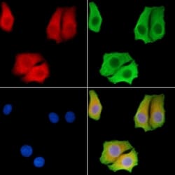 Invitrogen AGPAT1 Polyclonal Antibody 100 &mu;L; Unconjugated:Antibodies,