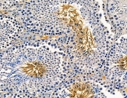 Invitrogen AGPAT1 Polyclonal Antibody 100 &mu;L; Unconjugated:Antibodies,
