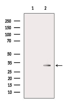 Invitrogen AGPAT1 Polyclonal Antibody 100 &mu;L; Unconjugated:Antibodies,
