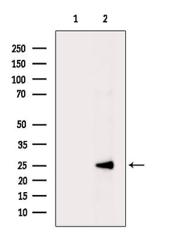 Invitrogen PSMD9 Polyclonal Antibody 100 &mu;L; Unconjugated:Antibodies,