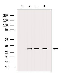 Invitrogen MRPS18B Polyclonal Antibody 100 &mu;L | Buy Online | Invitrogen&trade; | Fisher Scientific