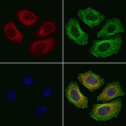 Invitrogen MRPS31 Polyclonal Antibody 100 &mu;L; Unconjugated:Antibodies,