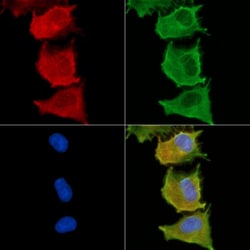 Invitrogen MOGAT3 Polyclonal Antibody 100 &mu;L; Unconjugated:Antibodies,