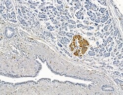 Invitrogen MOGAT3 Polyclonal Antibody 100 &mu;L; Unconjugated:Antibodies,