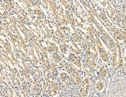 Invitrogen MOGAT3 Polyclonal Antibody 100 &mu;L; Unconjugated:Antibodies,