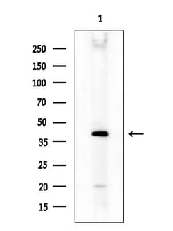Invitrogen MOGAT3 Polyclonal Antibody 100 &mu;L; Unconjugated:Antibodies,