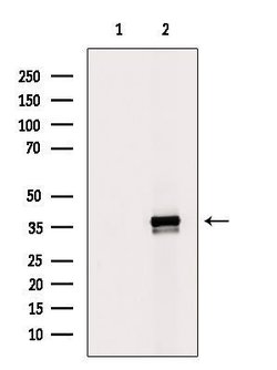 Invitrogen MRPL1 Polyclonal Antibody 100 &mu;L; Unconjugated:Antibodies,