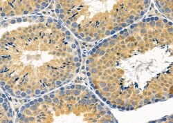 Invitrogen MRPL53 Polyclonal Antibody 100 &mu;L; Unconjugated:Antibodies,