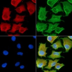 Invitrogen RPS15A Polyclonal Antibody 100 &mu;L | Buy Online | Invitrogen&trade; | Fisher Scientific