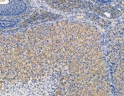 Invitrogen RPS15A Polyclonal Antibody 100 &mu;L | Buy Online | Invitrogen&trade; | Fisher Scientific