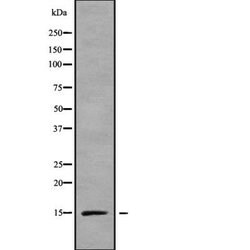 Invitrogen RPS15A Polyclonal Antibody 100 &mu;L | Buy Online | Invitrogen&trade; | Fisher Scientific