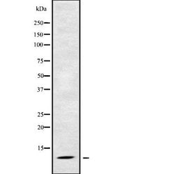 RPS21 Polyclonal Antibody:Antibodies, Polyclonal
