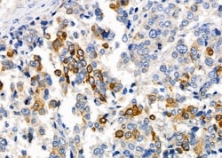 Invitrogen RPS4Y1/RPS4Y2 Polyclonal Antibody 100 &mu;L; Unconjugated:Antibodies,
