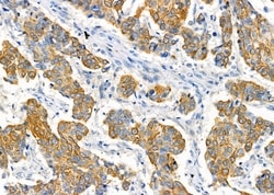 Invitrogen RPS4Y1/RPS4Y2 Polyclonal Antibody 100 &mu;L; Unconjugated:Antibodies,
