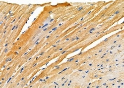 Invitrogen RPS4Y1/RPS4Y2 Polyclonal Antibody 100 &mu;L; Unconjugated:Antibodies,