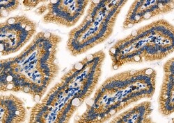 Invitrogen RPS4Y1/RPS4Y2 Polyclonal Antibody 100 &mu;L; Unconjugated:Antibodies,