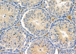 Invitrogen RPS4Y1/RPS4Y2 Polyclonal Antibody 100 &mu;L; Unconjugated:Antibodies,