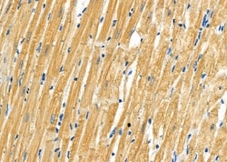 Invitrogen RPS4Y1/RPS4Y2 Polyclonal Antibody 100 &mu;L; Unconjugated:Antibodies,