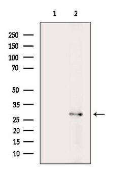 Invitrogen RPS4Y1/RPS4Y2 Polyclonal Antibody 100 &mu;L; Unconjugated:Antibodies,
