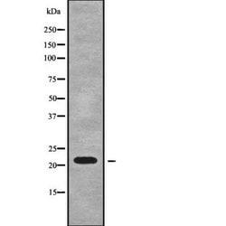 Invitrogen RPL18A Polyclonal Antibody 100 &mu;L; Unconjugated:Antibodies,