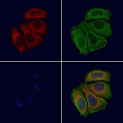 Invitrogen RPL24 Polyclonal Antibody 100 &mu;L; Unconjugated:Antibodies,